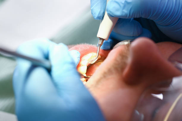 Best Emergency Dental Surgery in Blossom, TX