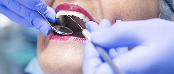Best Emergency Tooth Extraction in Blossom, TX